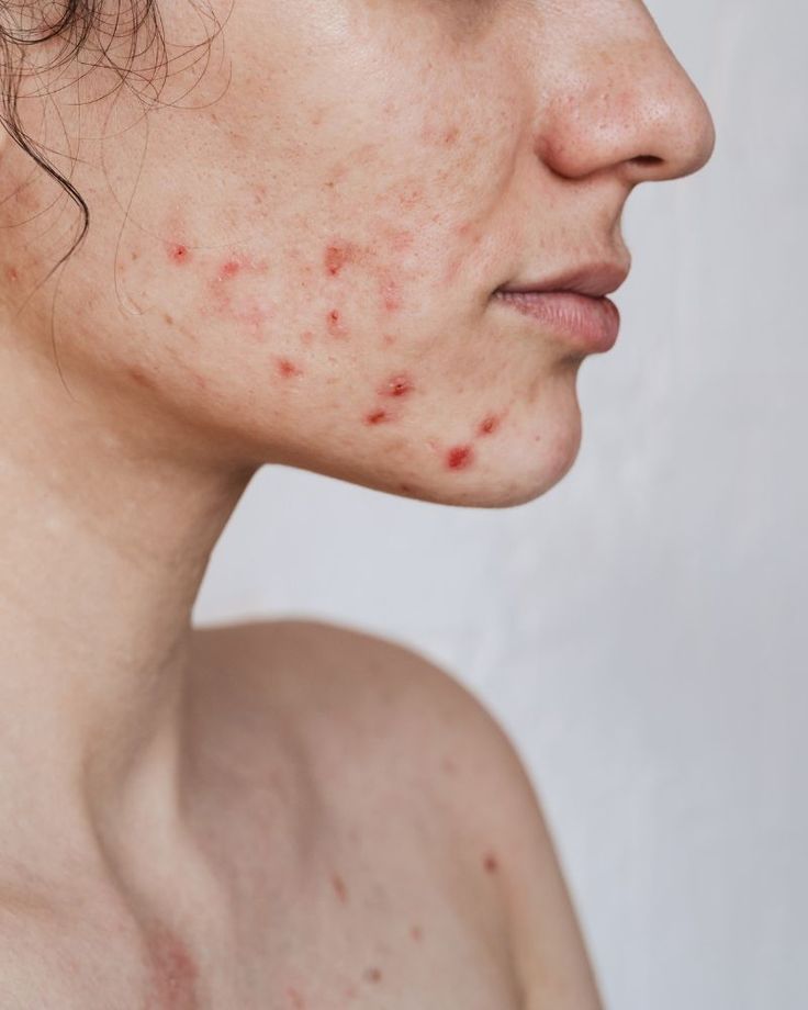 Disruptores endocrinos: lo que tu piel y tus hormonas NO quieren que ignores