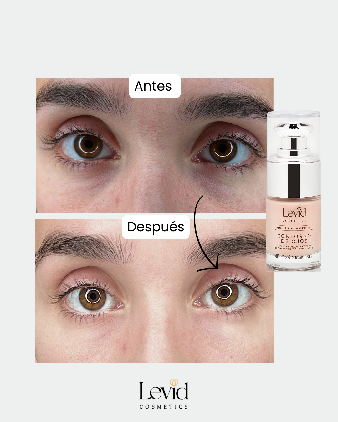 Ojeras y piel apagada