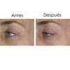 Resultados visibles tras aplicar el contorno de ojos y el sérum con Vin-up Lift, la alternativa natural al bótox. Reducción de las arrugas y patas de gallo.